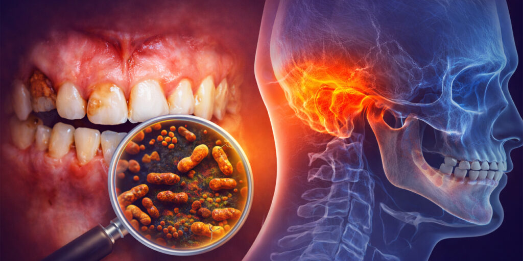 Ortodonti Gecikirse Ne Olur