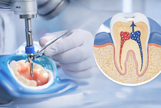 Diş Hastalıkları Tedavisi